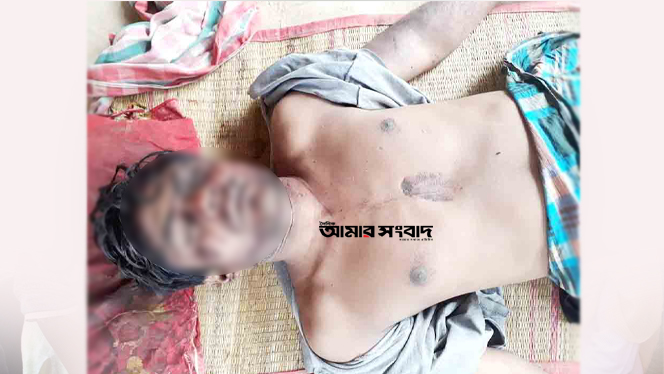 পুরুষরা সাবধান! প্রস্রাবের বেগ কমে আসে ৭টি কারণে
