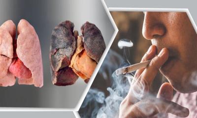 যে ৫ খাবারে ধূমপায়ীদের ফুসফুসও হবে পরিষ্কার!