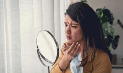 রোদে পোড়া কালচে ত্বক, প্রাকৃতিক উপায়ে সমাধান