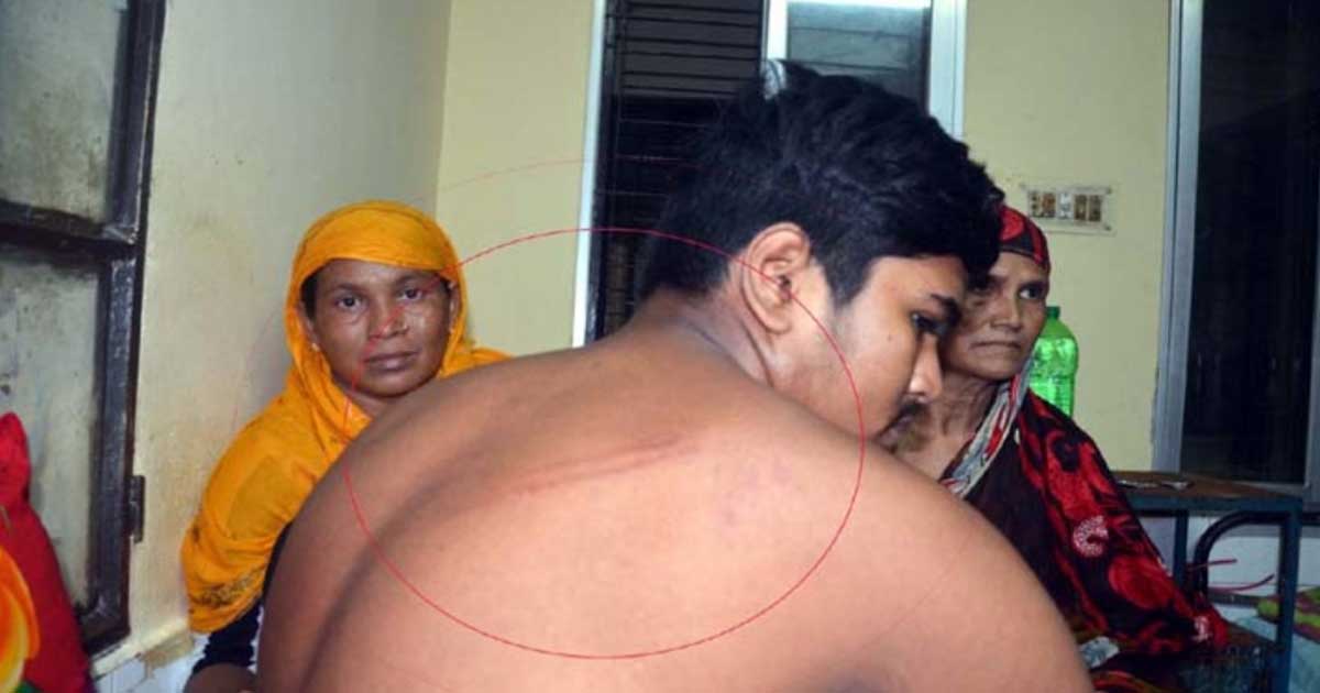 খোকসায় কিশোর গ্যাংয়ের হামলায় স্কুলছাত্র আহত
