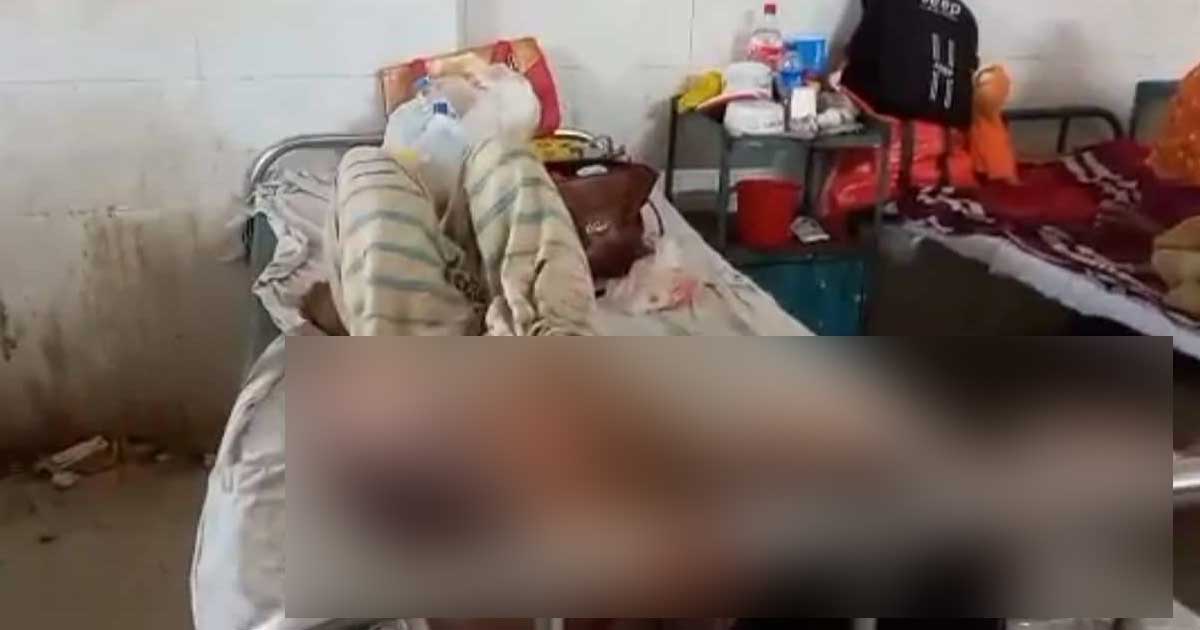 স্ত্রীর ছোঁড়া গরম পানিতে ঝলসে গেছে স্বামীর দেহ