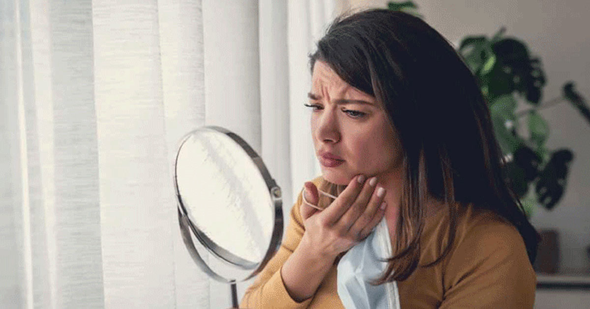 রোদে পোড়া কালচে ত্বক, প্রাকৃতিক উপায়ে সমাধান