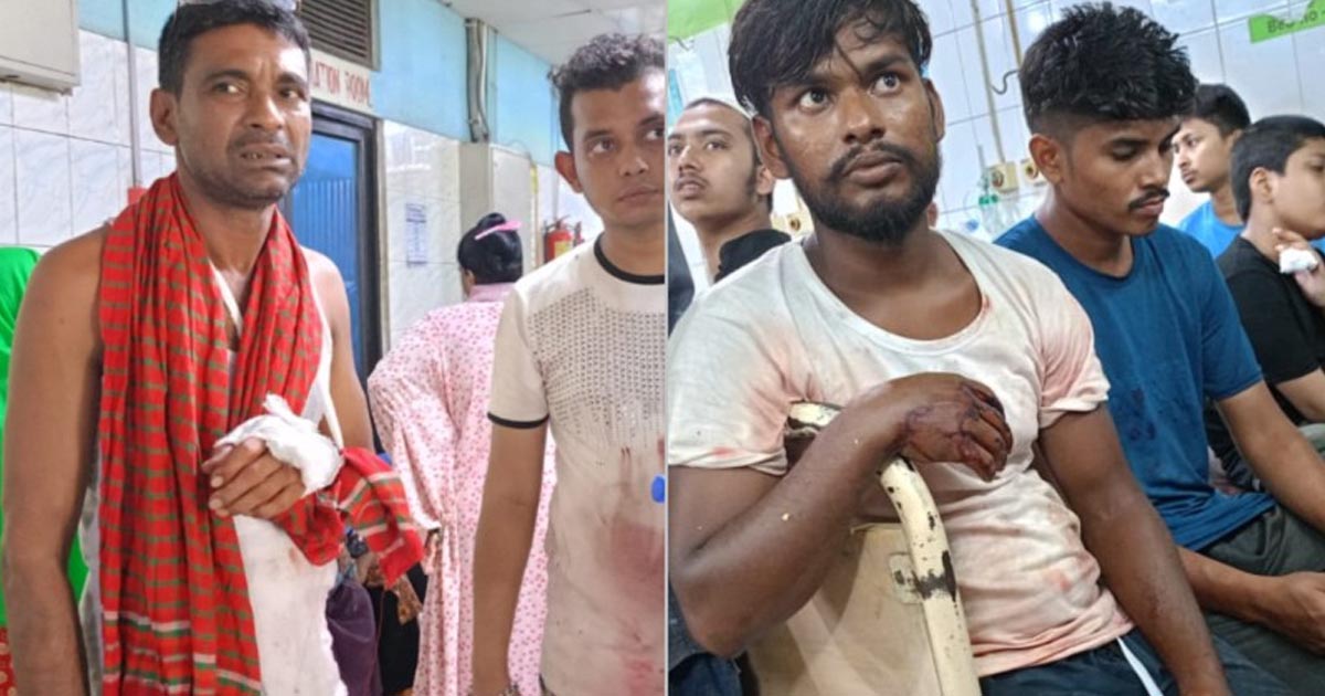 কোরবানি দিতে গিয়ে ১৪০ জন আহত, হাসপাতালে ভর্তি ১