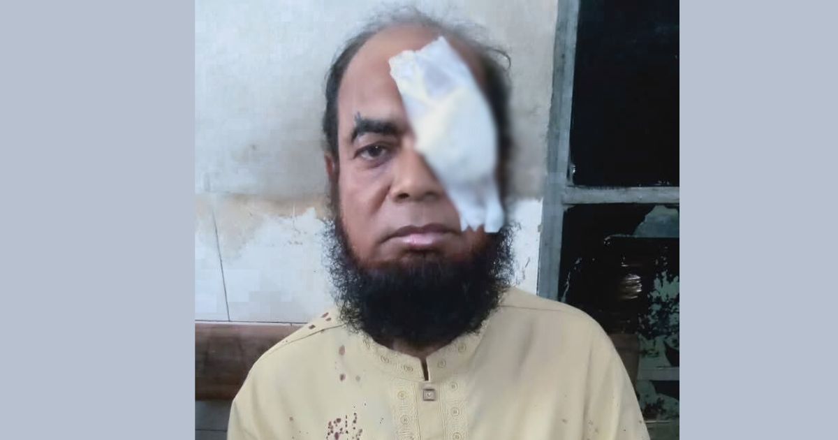 ময়মনসিংহে মাদ্রাসা সুপারের ওপর ‘সন্ত্রাসী’ হামলা, আজ শিক্ষক সমাজের প্রতিবাদ