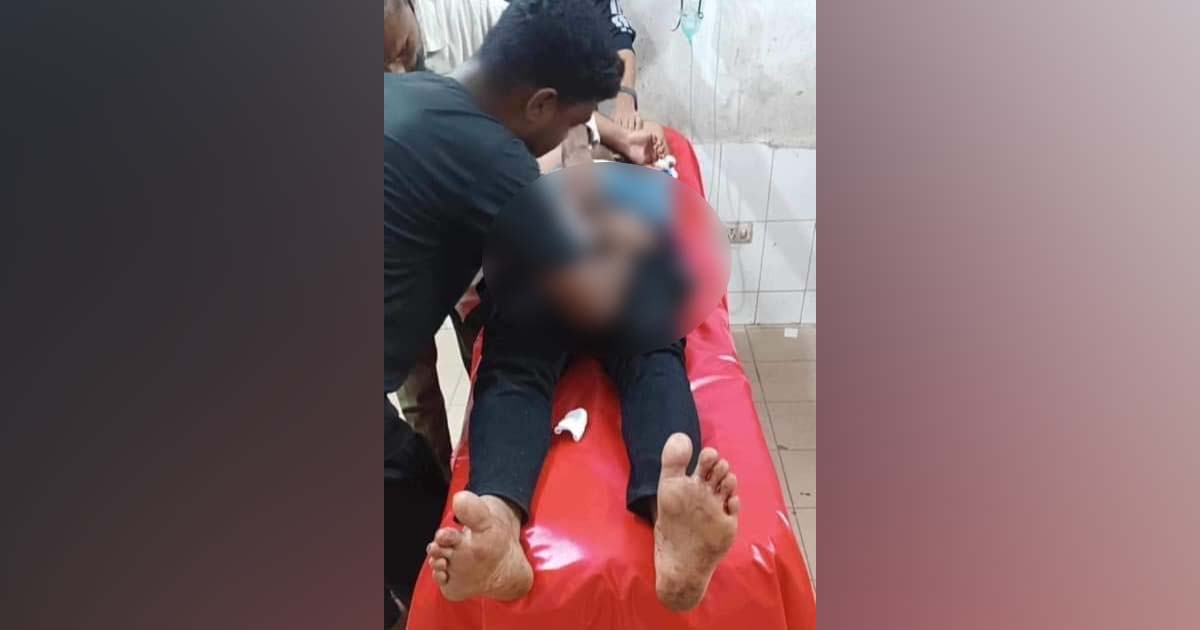 রেস্টুরেন্টে গিয়ে প্রেমিকের গোপনাঙ্গ কর্তন করল প্রেমিকা