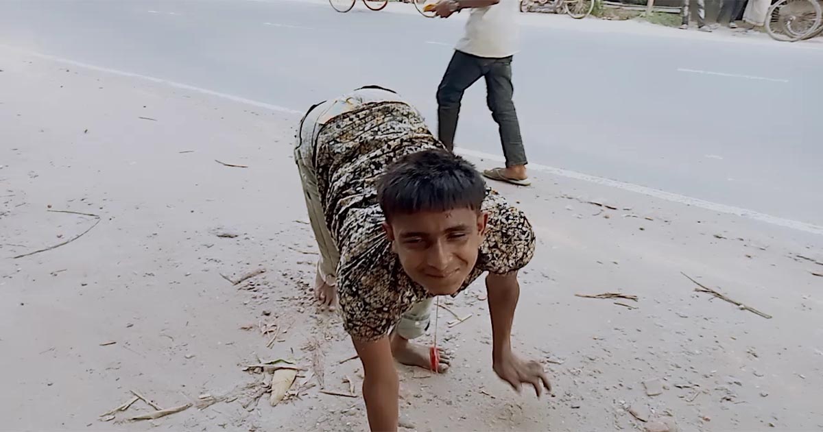 ‘আমিও ওদের মত হাঁটতে চাই’