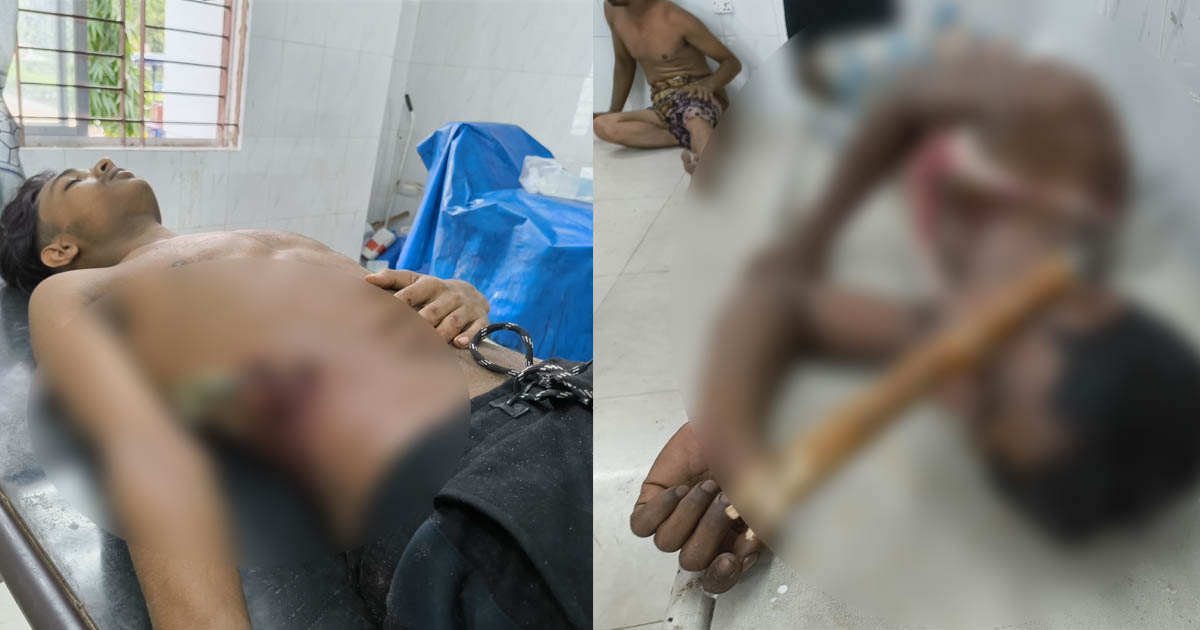 আম পাড়াকে কেন্দ্র করে সংঘর্ষ: টেঁটাবিদ্ধসহ আহত ৮