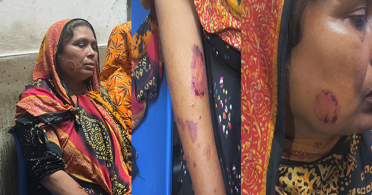 বউয়ের মায়ের কামড়ে হাসপাতালে ভর্তি স্বামীর মা
