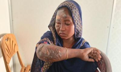 বালিয়াকান্দিতে গরম তেল নিক্ষেপ করে মা-মেয়েকে হত্যাচেষ্টার অভিযোগ