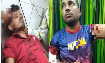 আড়াইহাজারে যুবলীগ নেতার হামলায় ছাত্রদল নেতা সহ ৩ জন আহত