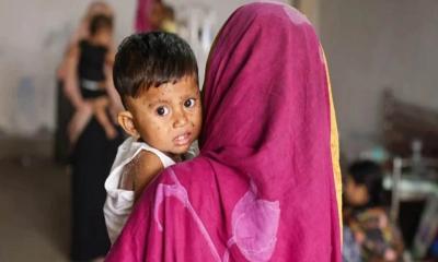 হামে আরও ৫ জনের মৃত্যু, নতুন আক্রান্ত ১১১৫