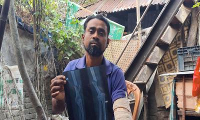 টাকার অভাবে চিকিৎসা বন্ধ দিনমজুর জাকিরের