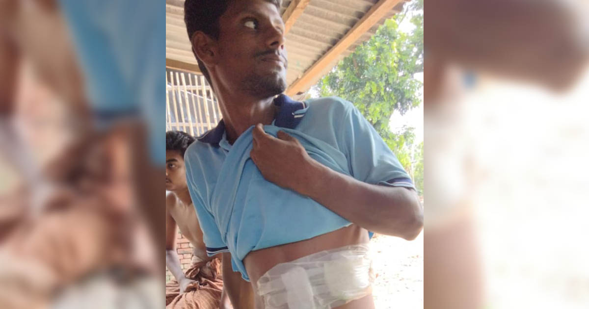 গুলিবিদ্ধ ‘জুলাই যোদ্ধা’ সজীবের মামলা ঘিরে মাগুরায় নতুন রাজনৈতিক প্রশ্ন