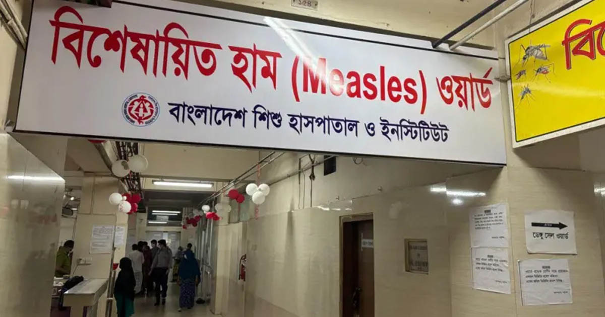 হামের উপসর্গ নিয়ে তিন বিভাগে আরও ৪ শিশুর মৃত্যু