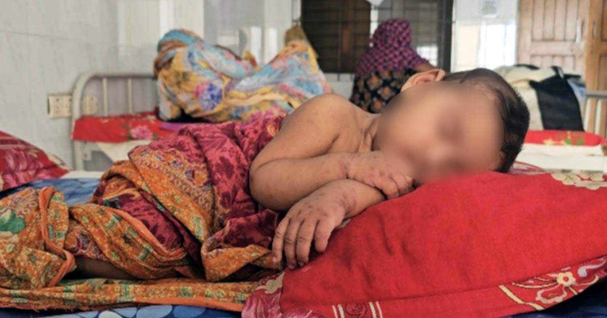 হামে আরও ৪ জনের মৃত্যু, নতুন শনাক্ত ৬৮৫