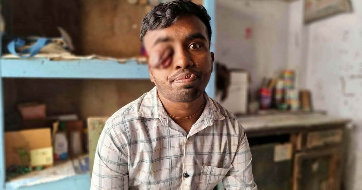 দৃষ্টি ফিরে পাওয়ার আকুতি কলেজছাত্র হৃদয়ের