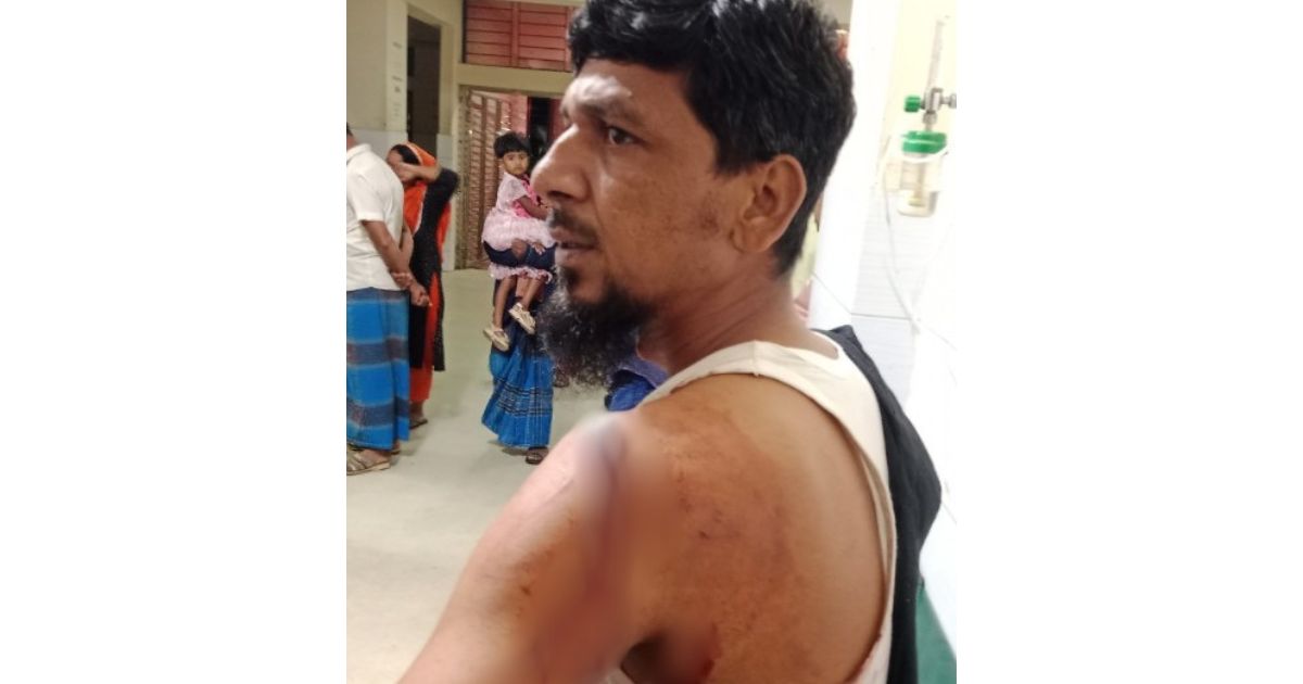নবীনগরে মাদক ব্যবসার প্রতিবাদ করায় ইউপি সদস্যকে ছুরিকাঘাত