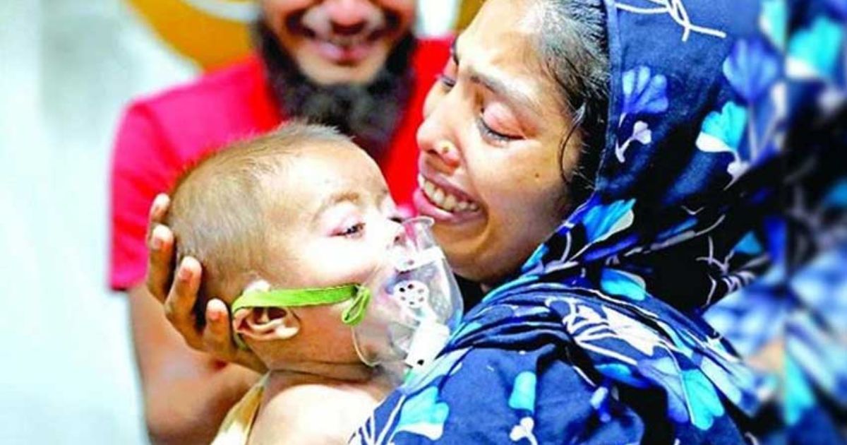 হাম ও উপসর্গ নিয়ে আরও ৭ জনের মৃত্যু