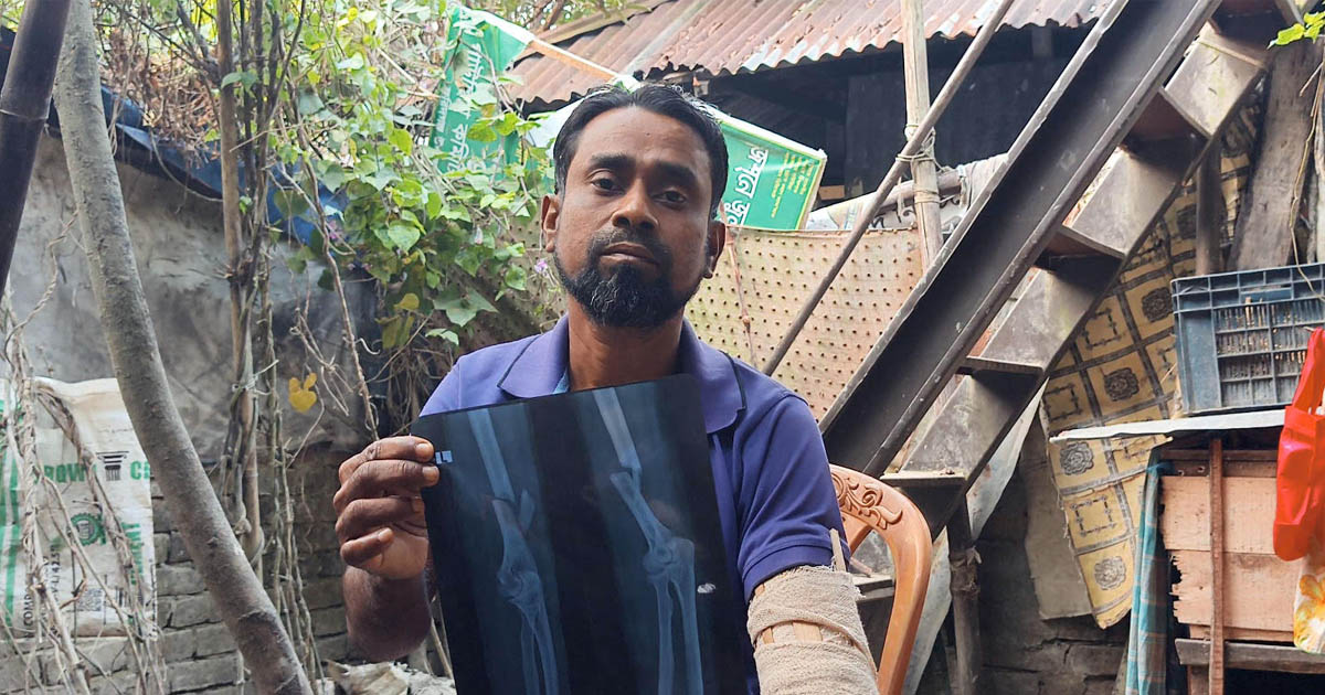 টাকার অভাবে চিকিৎসা বন্ধ দিনমজুর জাকিরের