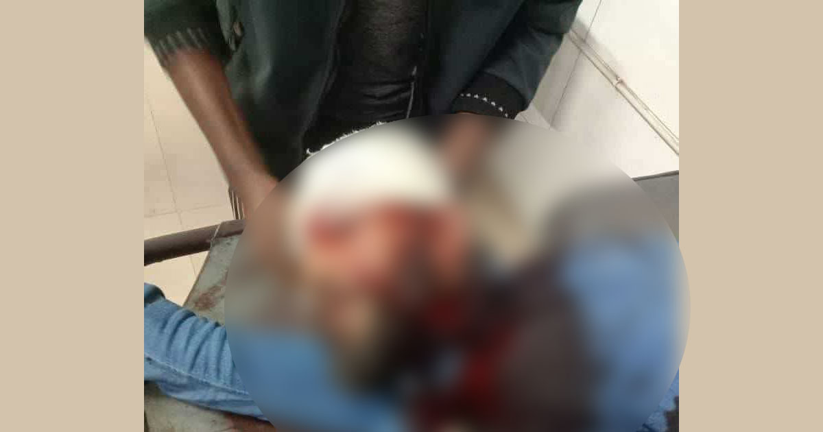 খুলনায় এনসিপি নেতার মাথায় গুলি, অবস্থা আশঙ্কাজনক 
