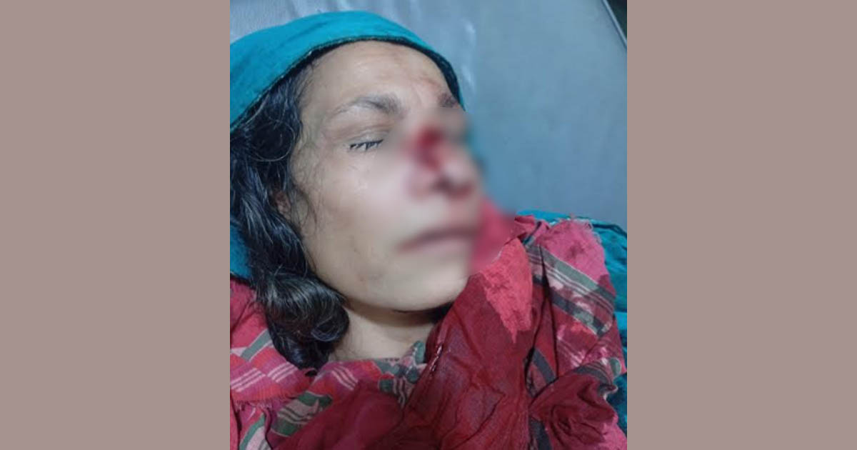 নাজিরপুরে প্রতিপক্ষের হামলায় গৃহবধূর নাক বিচ্ছিন্ন