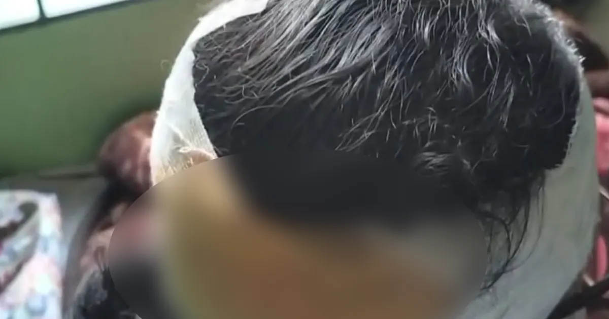 ঢাকায় গণসংযোগকালে জামায়াতের নারী নেত্রীকে কুপিয়ে জখম