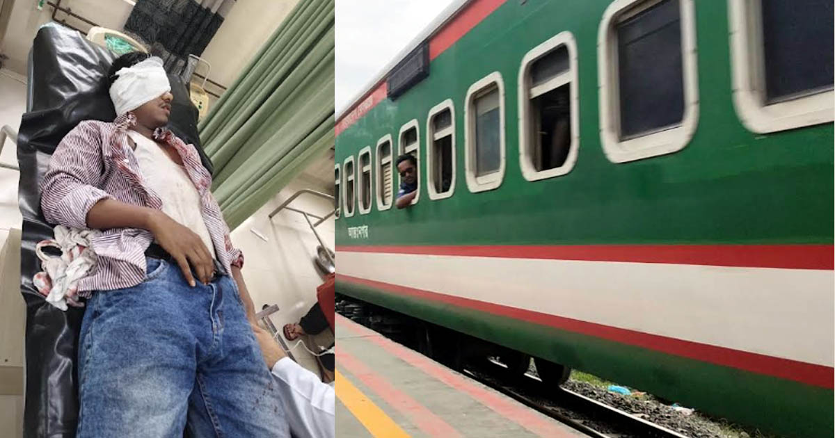 দ্রুতযান এক্সপ্রেসে পাথর নিক্ষেপ, চোখ হারালো শিক্ষার্থী