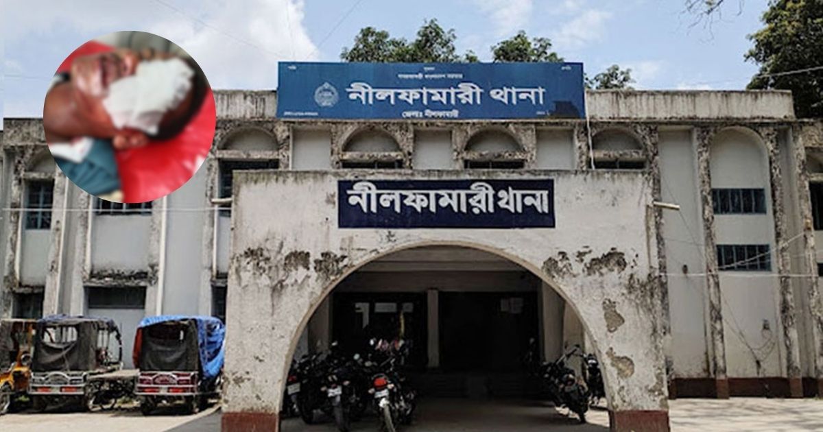 নীলফামারীতে পূর্ব শত্রুতার জেরে দুই দফা হামলা, চোখে গুরুতর জখম