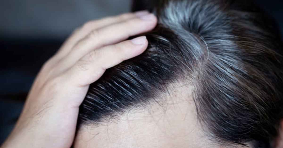 যেসব কারণে অল্প বয়সেই চুল পেকে যায়