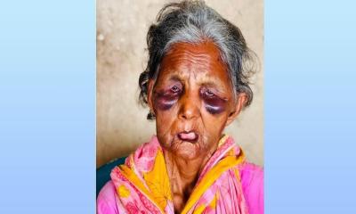 হামলার শিকার নরসিংদীর সেই বাকপ্রতিবন্ধী বৃদ্ধা বুবি আর নেই