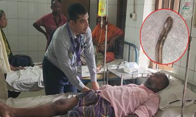 সাপের কামড় খেয়ে সেই সাপ নিয়েই হাসপাতালে হাজির রোগী!