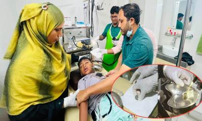 ফরিদপুরে ৭ বছরের শিশুর পাকস্থলী থেকে অস্ত্রোপচার ছাড়াই বের করা হলো ৫ টাকার কয়েন