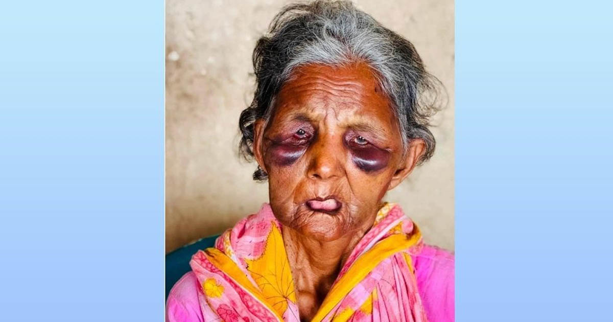 হামলার শিকার নরসিংদীর সেই বাকপ্রতিবন্ধী বৃদ্ধা বুবি আর নেই