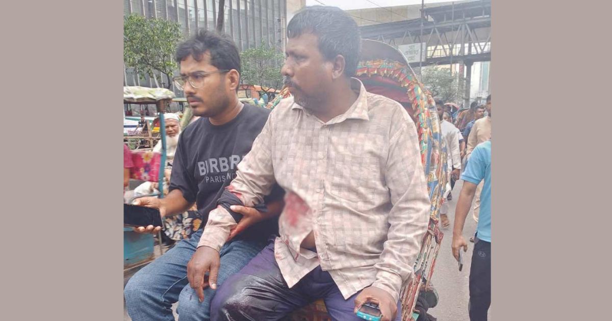 মতিঝিলে ব্যবসায়ীকে গুলি করে ১৭ লাখ টাকা ছিনতাই