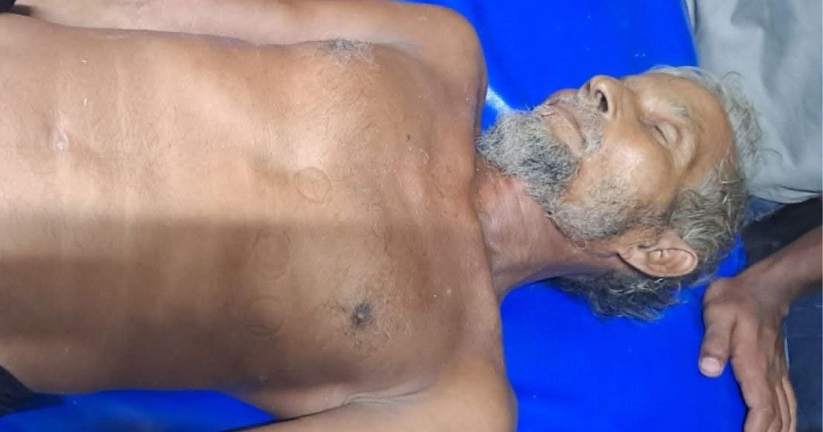 কুষ্টিয়ায় বজ্রপাতে বৃদ্ধের মৃত্যু, আহত ৪