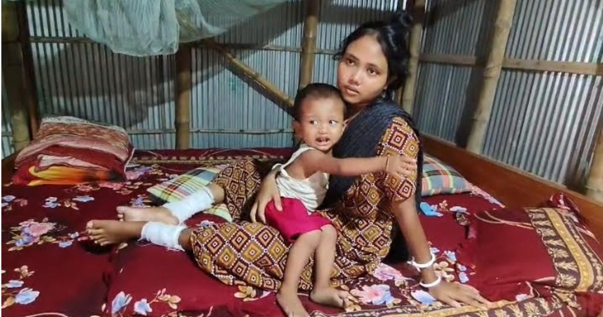 হাতীবান্ধায় গৃহবধূর দুই পা ভাঙার অভিযোগ স্বামীর বিরুদ্ধে, আদালতে মামলা